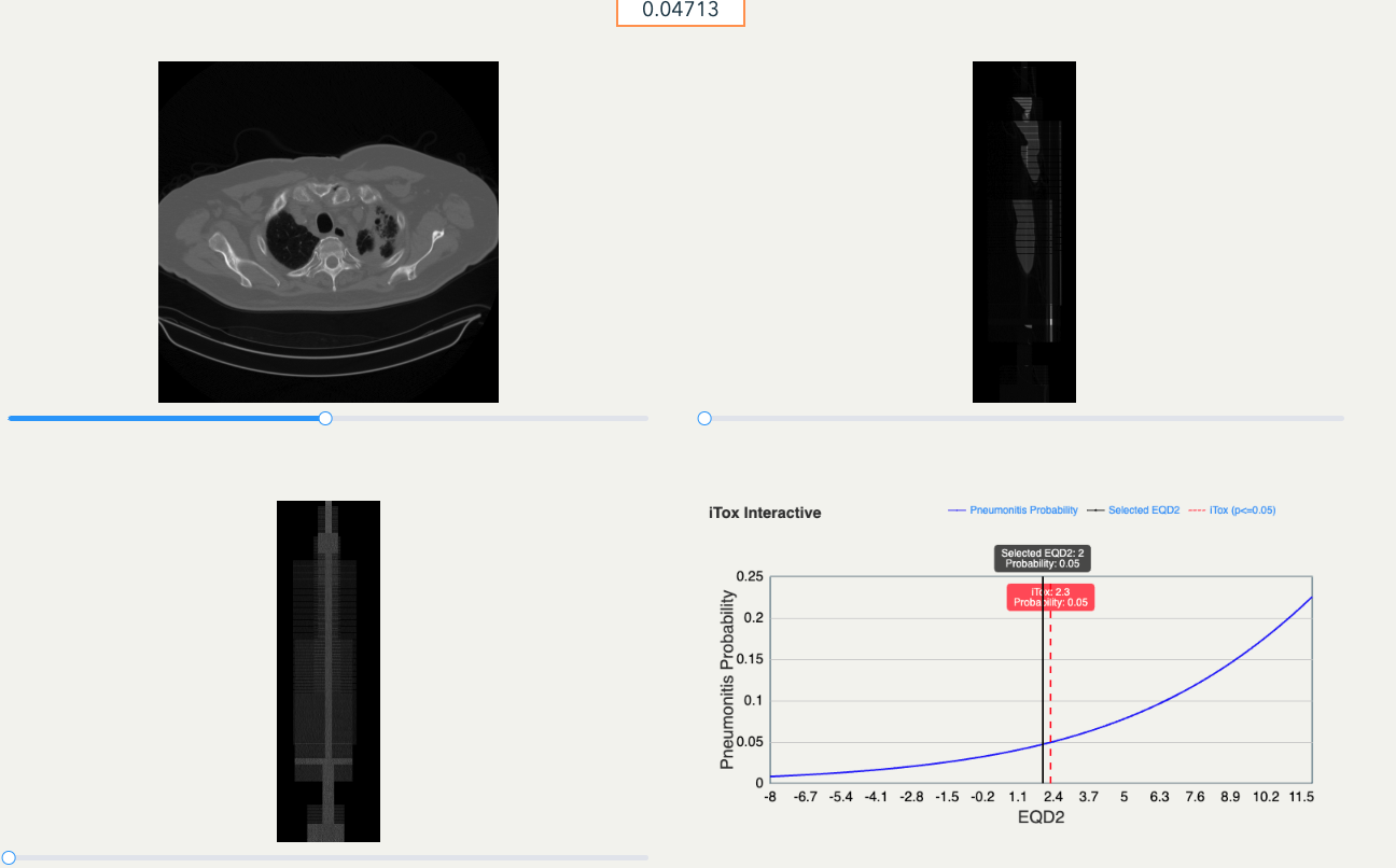 iTox: Deep Learning for Pneumonitis Prediction